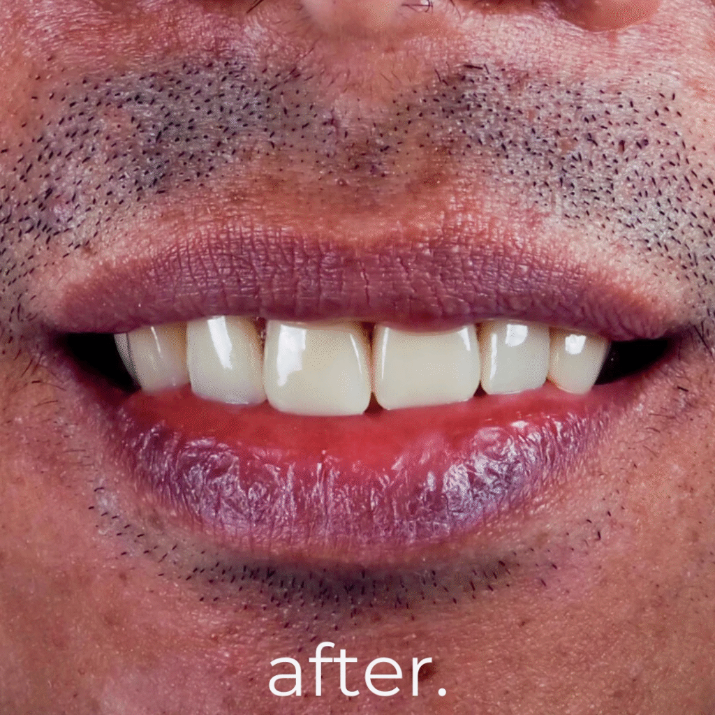 image-2-1024x1024 5 Best Dental Clinic in Bali Recommendations